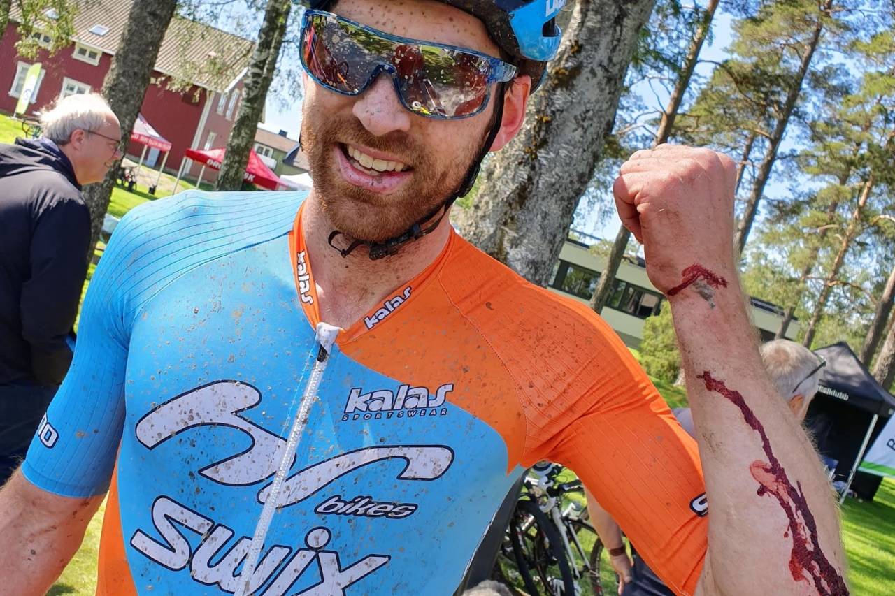 Vidar Mehl syklet rett til skogs i 40 kilometer i timen, men traff en haug med kvist i stedet for et tre eller en steinur. Foto: Helene Haugland